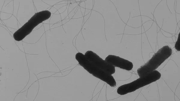 В России почти в пять раз сократилась заболеваемость сальмонеллезом