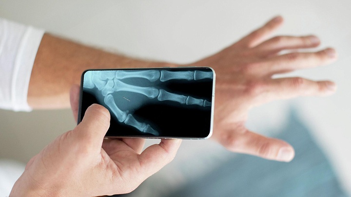 В Белгороде приблизились к созданию источника рентгена размером со смартфон