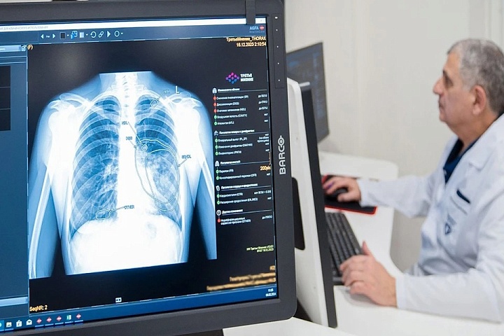 Московские ИИ-сервисы теперь доступны медикам из всех регионов России